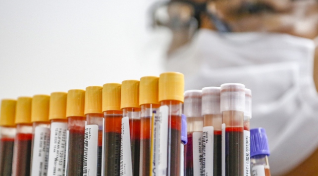 İki yeni araştırmaya göre kan grubu 0 olanların ‘COVID-19’a yakalanma ve hastalığı ağır geçirme riski daha az’