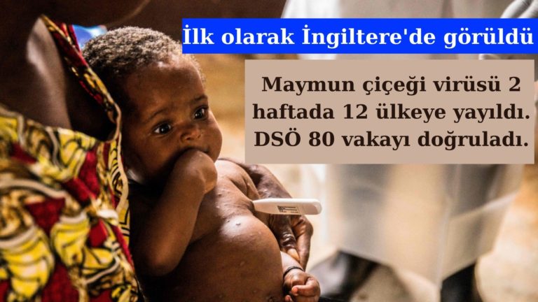 Maymun çiçeği virüsü 12 ülkeye yayıldı