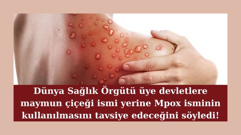 Maymun çiçeği ismi yerine Mpox kullanılacak!