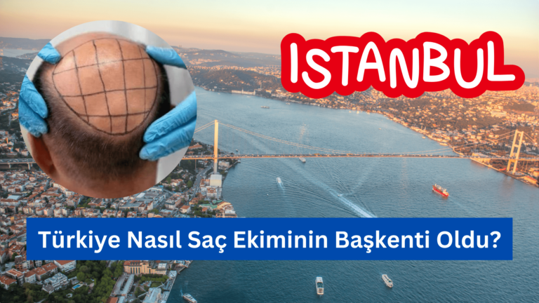 Türkiye Nasıl Saç Ekiminin Başkenti Oldu?